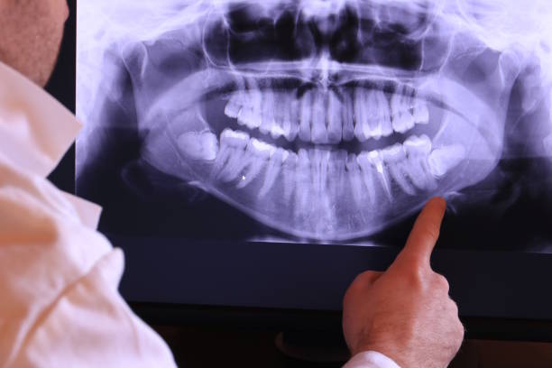 Best Emergency Denture Repair in Mitchell, IL