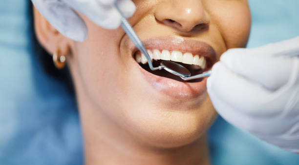Best Same-Day Emergency Dental Services in Mitchell, IL