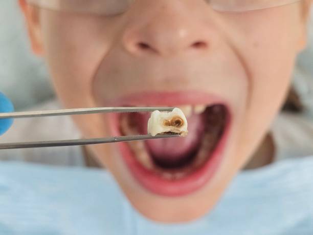 Best Same-Day Emergency Dental Services in Mitchell, IL