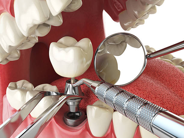 Best Same-Day Emergency Dental Services in Mitchell, IL