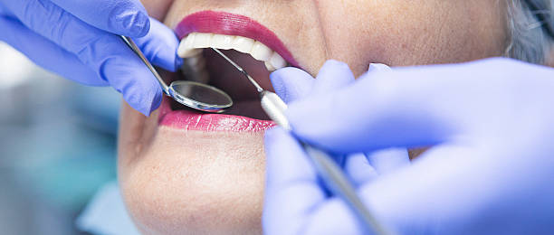 Best Pediatric Emergency Dentist in Mitchell, IL